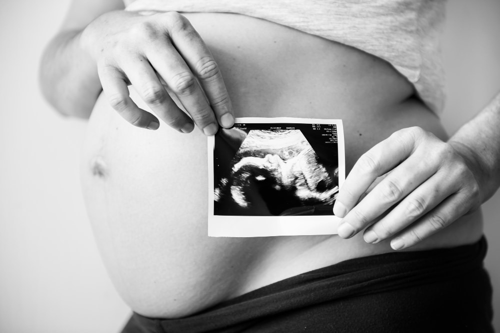 phot femme enceinte